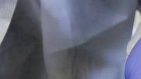 La carrera en el mundo por vacuna contra coronavirus.