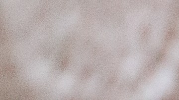 El niño tuvo un terrible accidente con una pesada mesa de granito.