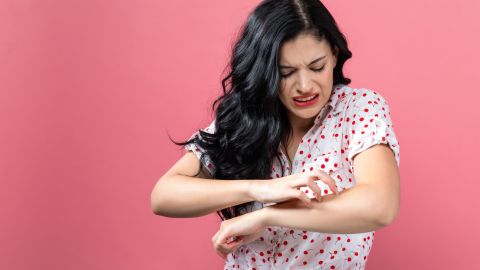 eczema