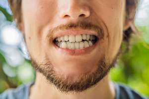 Los dientes rotos son otra consecuencia de la pandemia (y qué puedes hacer para evitarlo)