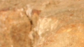 La serpiente mordió al hombre en la mano.