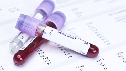 anticuerpos sangre