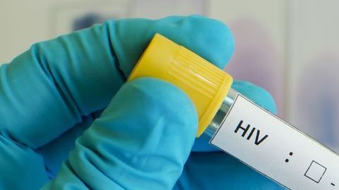 Los contagios de VIH han aumentado en la comunidad latina.
