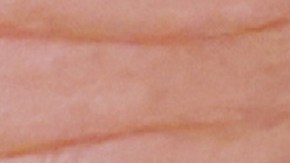 Según la Casa Blanca, el vicepresidente tuvo conjuntivitis.