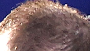 Prescott salió con lágrimas en los ojos tras la impresionante lesión.