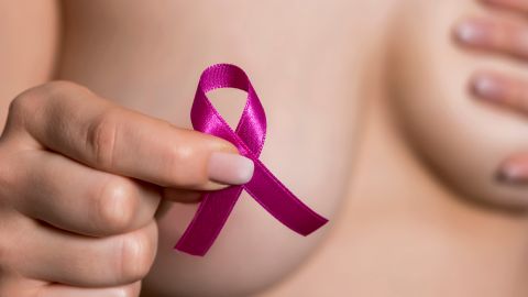 Muchas mujeres desarrollan linfedema después de una cirugía de cáncer de pecho.