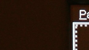 Imagen ilustrativa de una mamografía.