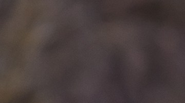 Pensó que llevaba una serpiente en el cuello, pero era algo peor.