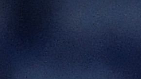 Hirving Lozano tuvo que salir del campo con ayuda del staff del equipo.