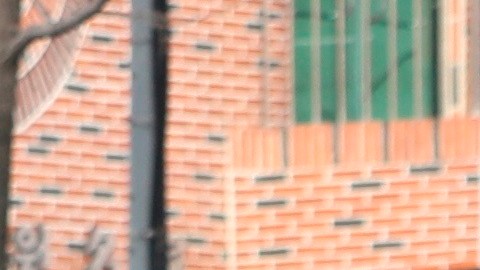 Los doctores pensaron que tenía herpes zóster.