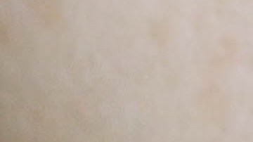 labios secos