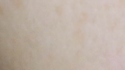 labios secos