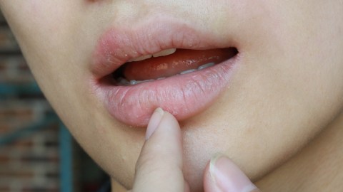 labios secos