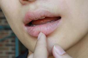 Cómo evitar los labios resecos