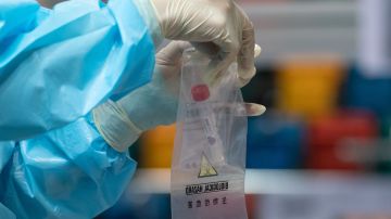 China hará análisis anales de detección de coronavirus