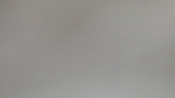 Un hombre con lepra en Nepal.