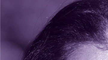 Se estima que unos  30 millones de estadounidenses sufren una enfermedad rara.