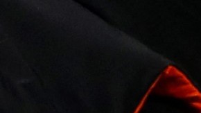 El escalofriante golpe que recibió Rui Patricio que dejó en vilo a toda Inglaterra