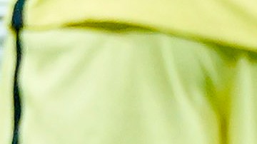 Fuerte lesión en el partido entre América y Olimpia.