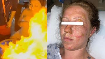 VIDEO: Jovencita estadounidense se quema el rostro con bebida en Cancún; culpa al mesero y pide justicia