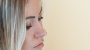 ecografía abdominal