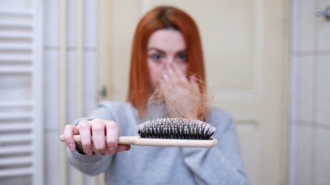 pérdida de cabello