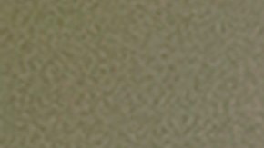 Trombosis vacuna Johnson & Johnson