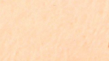 Alertan por peligroso aumento de garrapatas en Estados Unidos