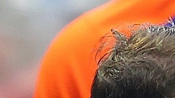 El jardinero de 32 años estará en la lista de lesionados.