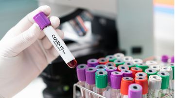 La prueba de antígenos es la más rápida, pero también la que con mayor frecuencia arroja resultados erróneos