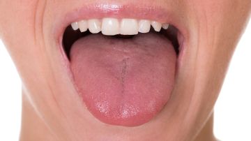 Macroglosia lengua coronavirus