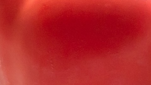 Es importante monitorear la presión arterial si hay historial familiar de problemas cardiovasculares.