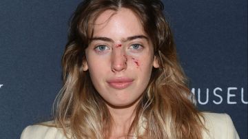 Clara, la hija de Ewan McGregor, fue atacada en la cara por un perro