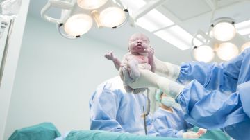 Corte bebé durante cesárea