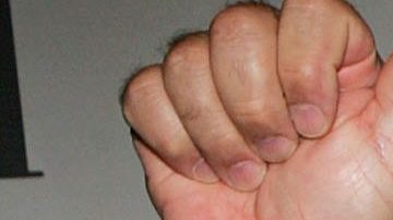 Willie Colón habla por primera vez del accidente que casi le cuesta la vida.