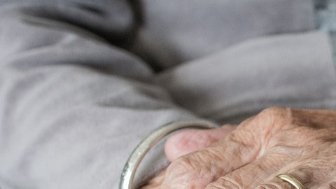 Murió joven con enfermedad de Benjamin Button.