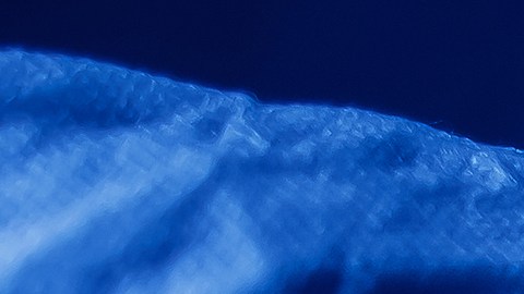 Hongo Candida Auris