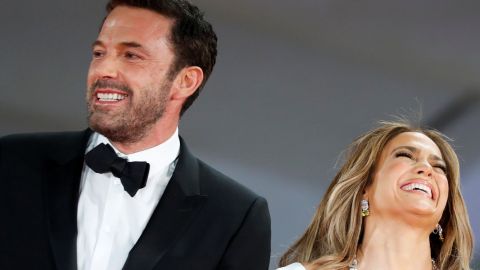 Ben Affleck sonrió tanto al lado de Jennifer López que un detalle en su boca quedó en evidencia Ben Affleck sonrió tanto al lado de Jennifer López que un detalle en su boca quedó en evidencia.