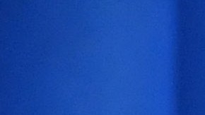 Unidad de Cuidados Intensivos (UCI)