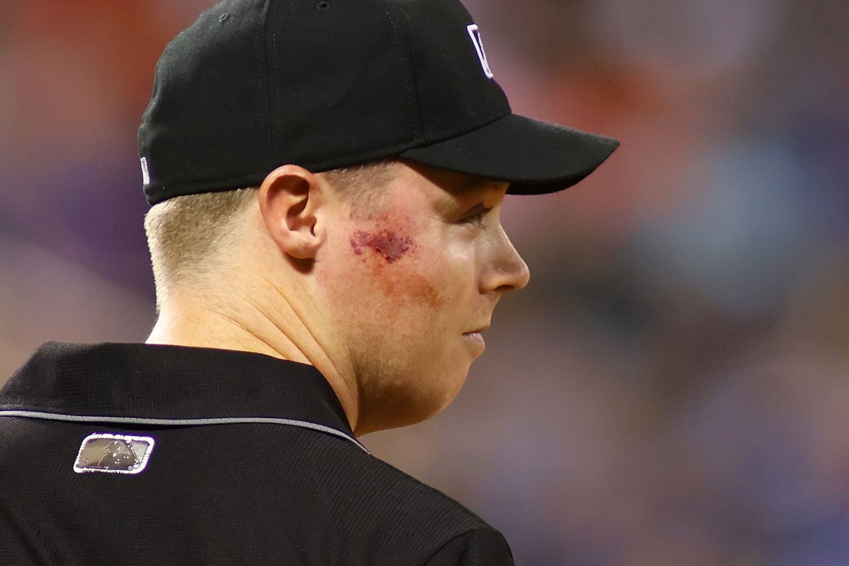 Referee was left bleeding after receiving a ball in the face during a Major League game [Video]