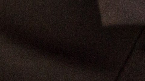 Woman,With,Injured,Foot