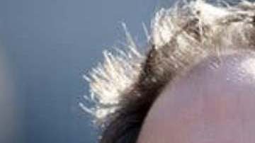 Zack Scott a comienzos del verano.