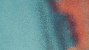 Bebé se cae de incubadora y le dicen a sus padres que tiene Síndrome de Down