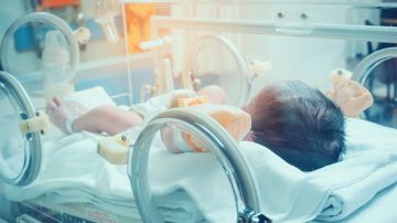Bebé se cae de incubadora y le dicen a sus padres que tiene Síndrome de Down