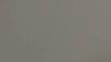 Bebé quemaduras padrastro