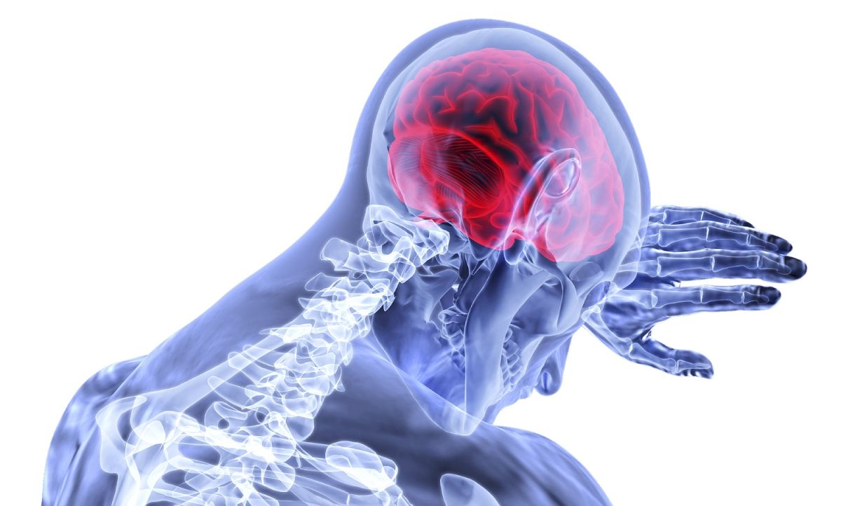 Un derrame cerebral puede causar discapacidad permanente o la muerte.