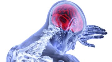 Derrame cerebral: 5 señales fulminantes que debes atender de inmediato