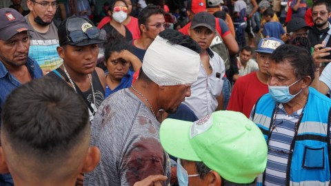 Migrantes lesionados tras una pelea este domingo por un robo mientras se dirigían en caravana hacia el norte de México.