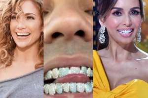 La sonrisa de los famosos que se volvieron moda: ¿Posible o peligroso?