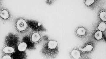imagen de la nueva variante cepa del coronavirus omicron